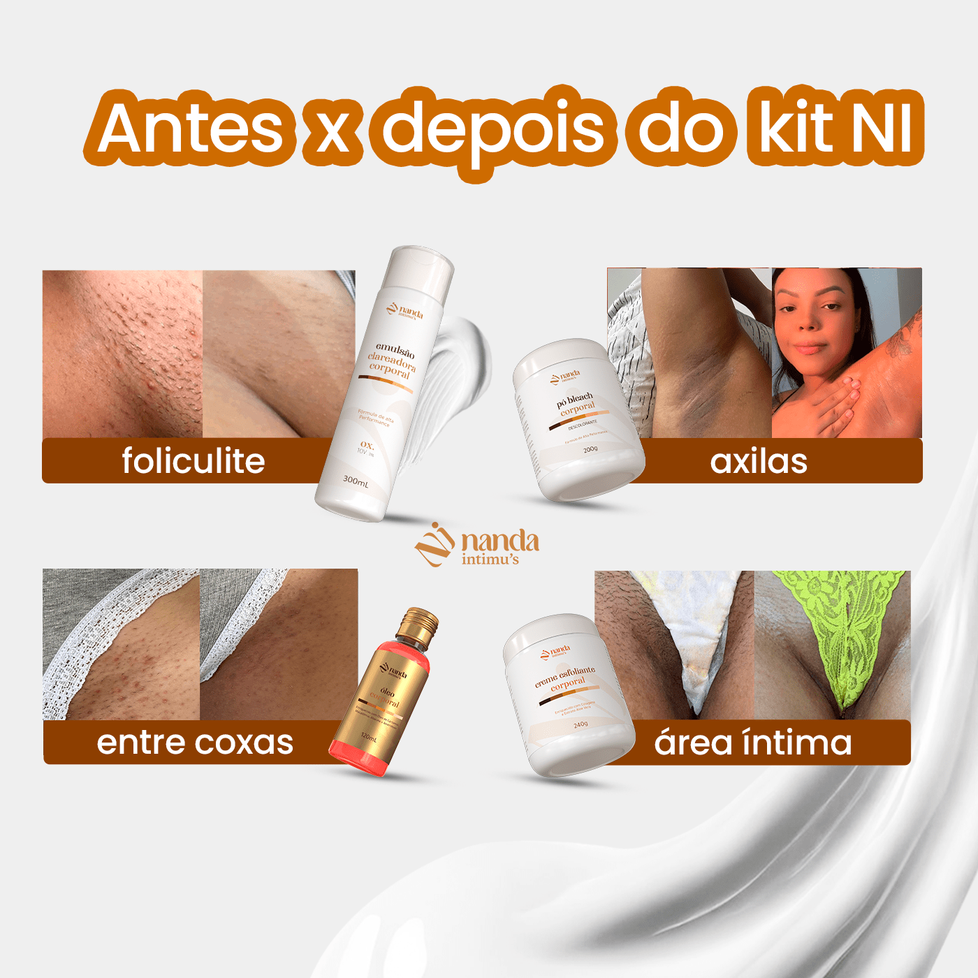 Kit Clareador de Manchas | Tratamento 1 Ano com + 2 Depiladores - Nanda Intimus