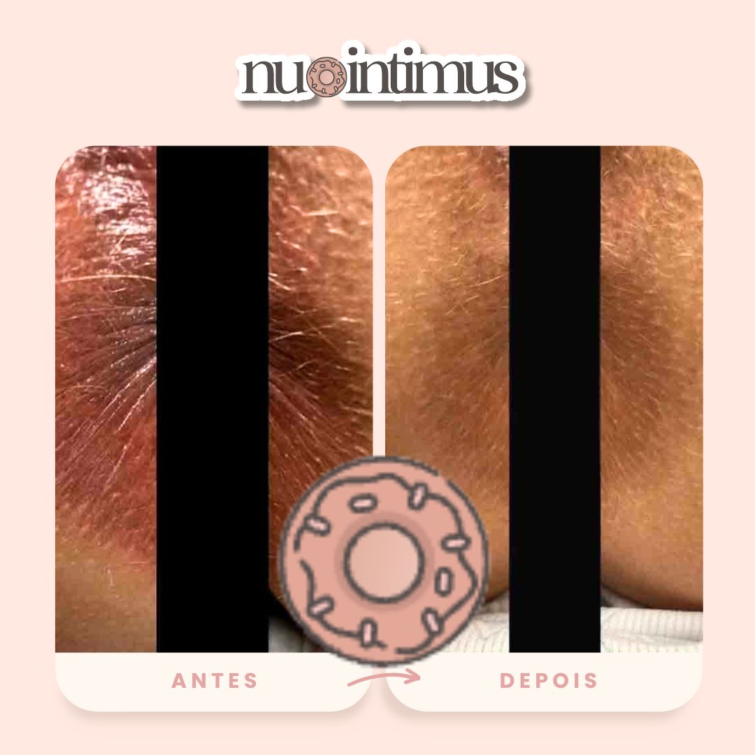Nu Intimus - Creme Clareador Anal - Nanda Intimus