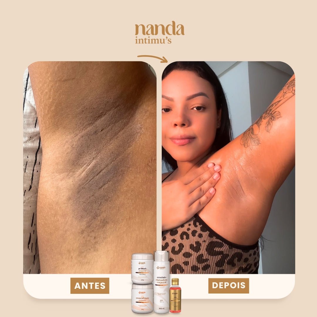 Kit Clareador de Manchas | Tratamento 6 Meses com 3 Kits + 1 Depilador - Nanda Intimus
