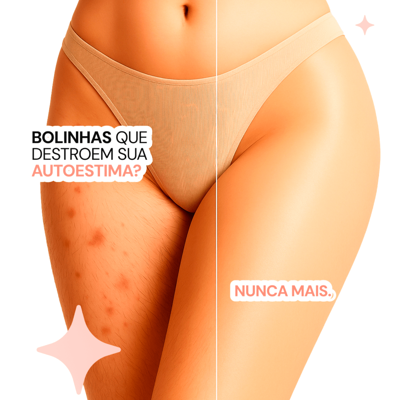 3 Depiladores Anti Foliculite Nanda Intimus - Nanda Intimus