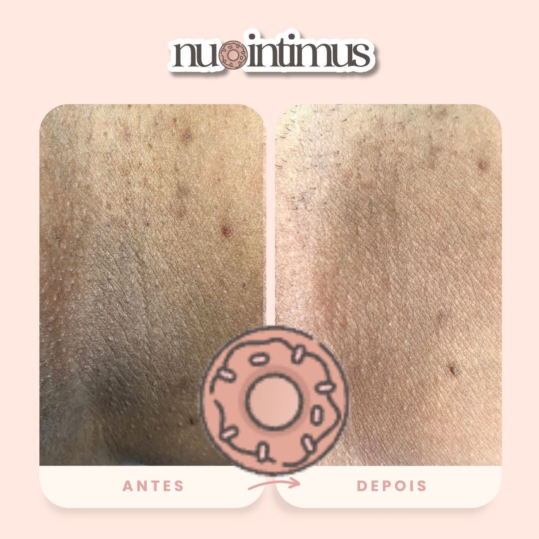 Nu Intimus Creme Clareador Anal