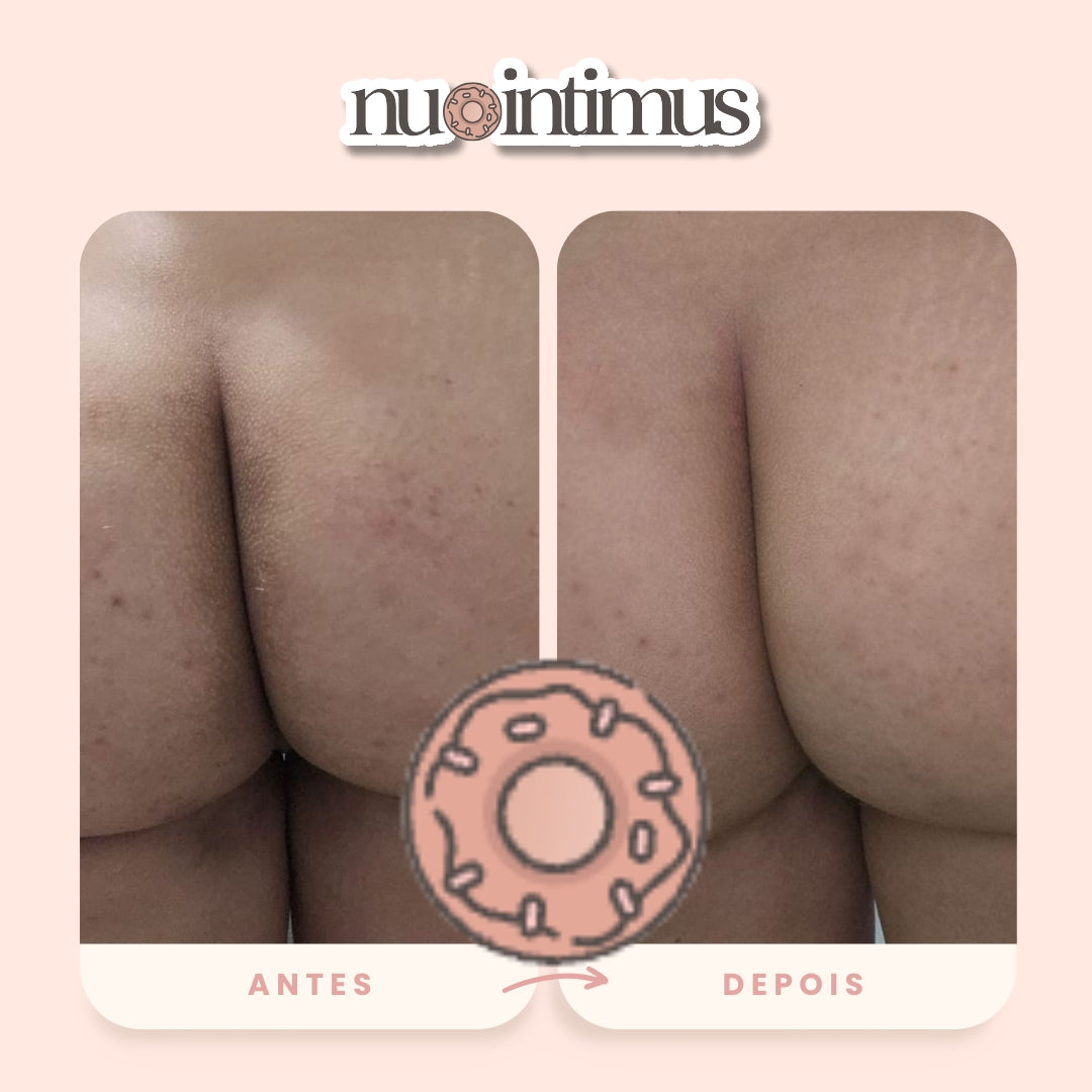 Nu Intimus Creme Clareador Anal