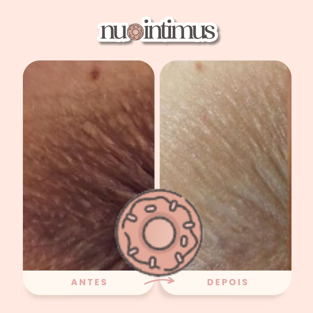 Nu Intimus Creme Clareador Anal